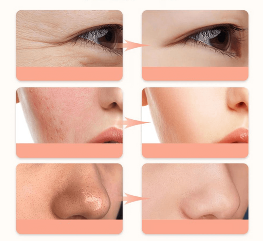 Hudföryngring LED Skönhetsmask